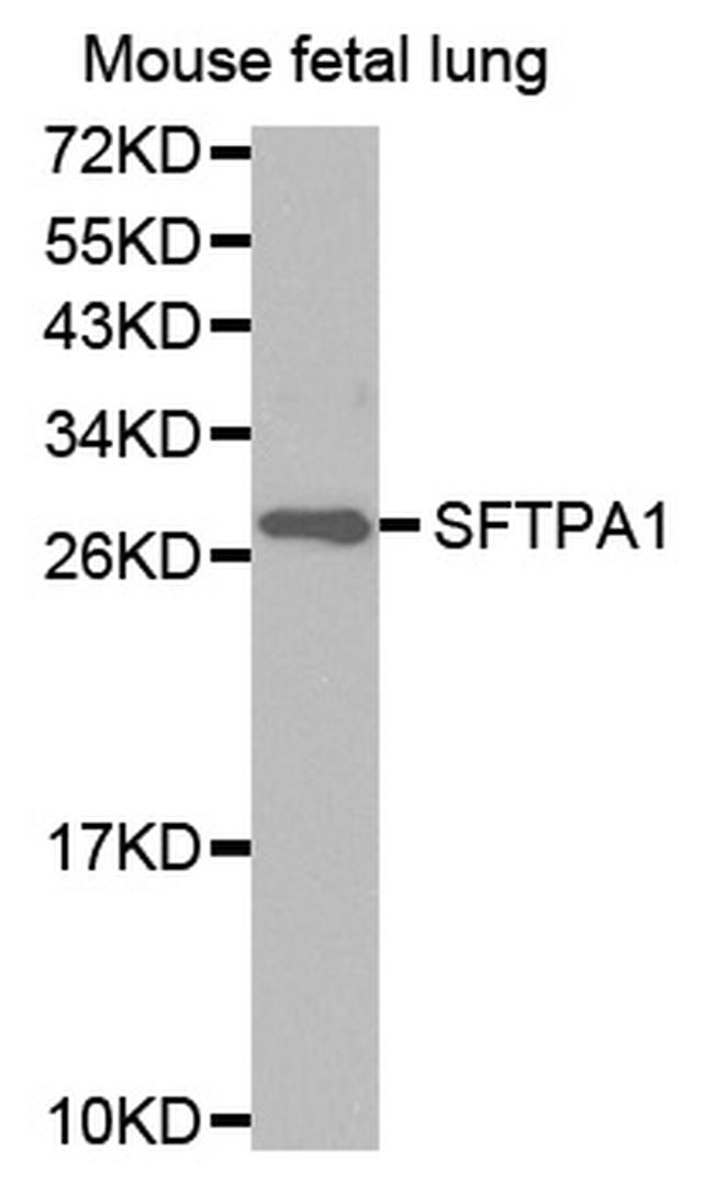 SFTPA1 Antibody in Western Blot (WB)