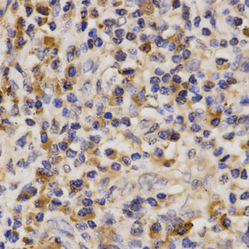 ABCA6 Antibody in Immunohistochemistry (Paraffin) (IHC (P))