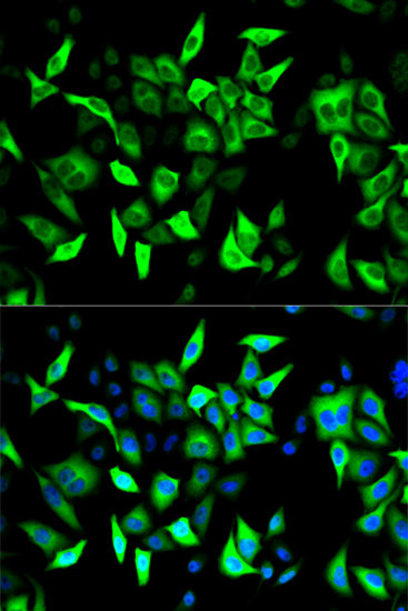 RRM2 Antibody in Immunocytochemistry (ICC/IF)