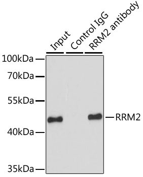 RRM2 Antibody in Immunoprecipitation (IP)