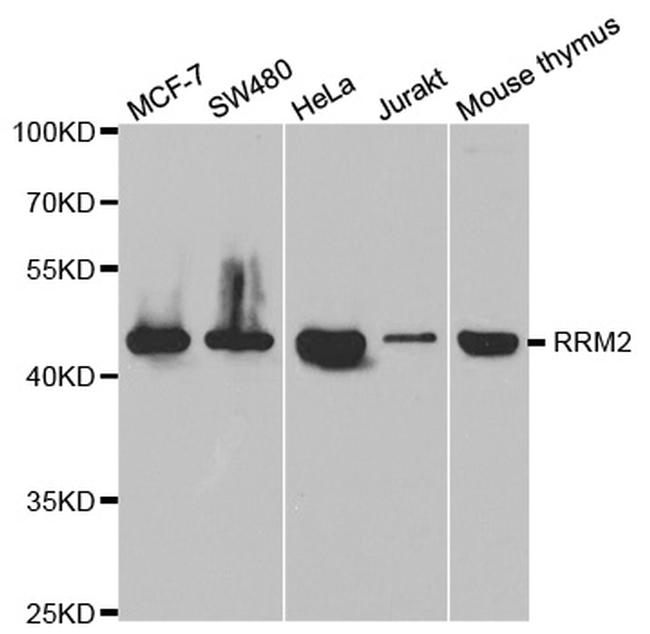 RRM2 Antibody in Western Blot (WB)