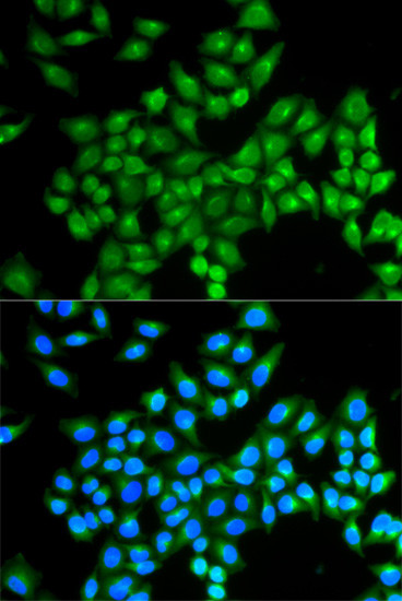 DAO Antibody in Immunocytochemistry (ICC/IF)