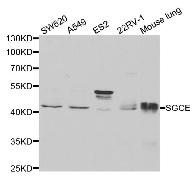 SGCE Antibody in Western Blot (WB)