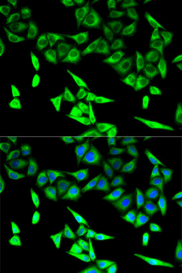 HADHA Antibody in Immunocytochemistry (ICC/IF)