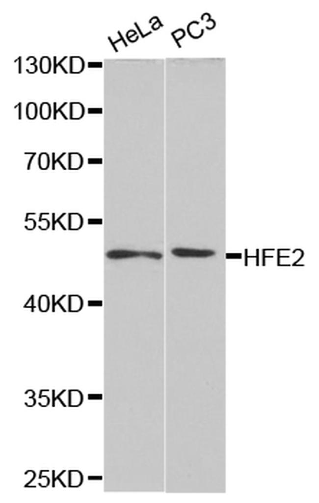 HFE2 Antibody in Western Blot (WB)