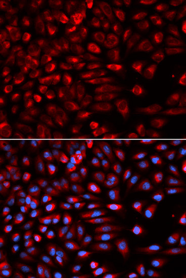 NEK2 Antibody in Immunocytochemistry (ICC/IF)