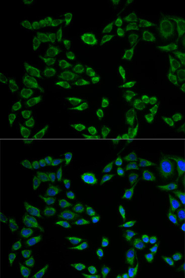 VAPB Antibody in Immunocytochemistry (ICC/IF)