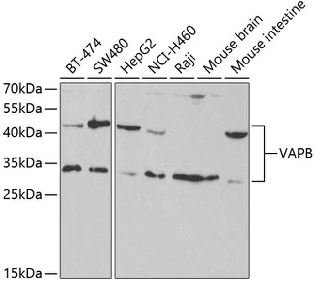 VAPB Antibody in Western Blot (WB)