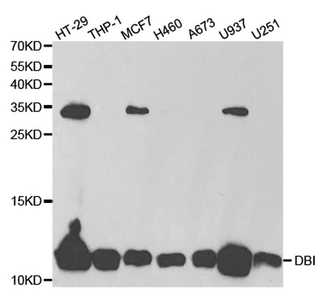 Diazepam Binding Inhibitor Antibody in Western Blot (WB)