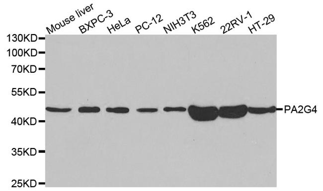 EBP1 Antibody in Western Blot (WB)