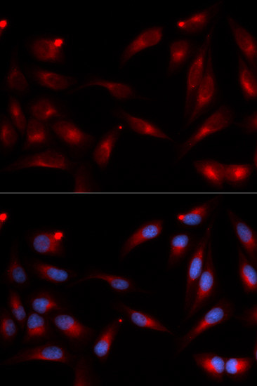 ADAM9 Antibody in Immunocytochemistry (ICC/IF)