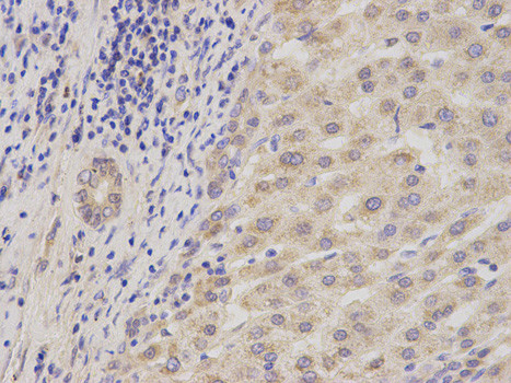 ADAM9 Antibody in Immunohistochemistry (Paraffin) (IHC (P))