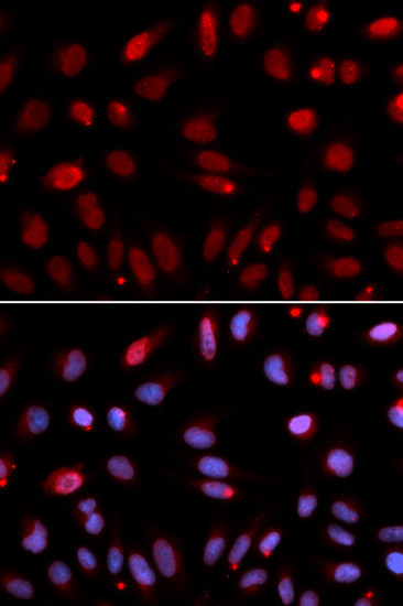 HUS1 Antibody in Immunocytochemistry (ICC/IF)