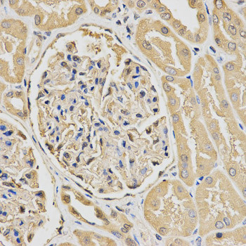 HUS1 Antibody in Immunohistochemistry (Paraffin) (IHC (P))