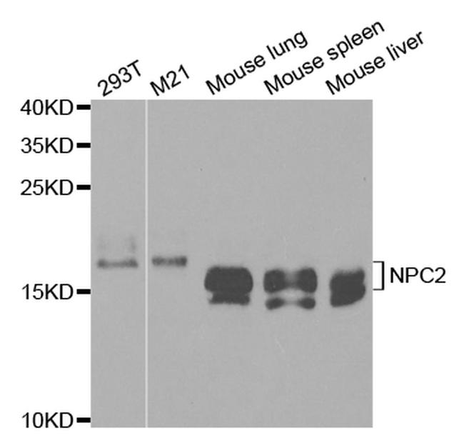 NPC2 Antibody in Western Blot (WB)