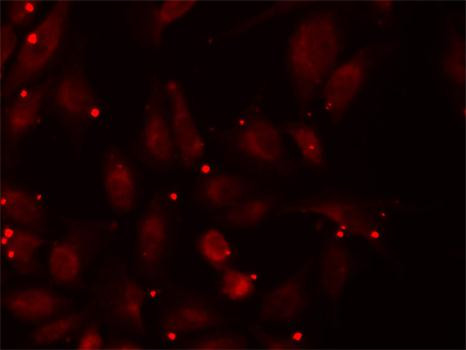 PCCB Antibody in Immunocytochemistry (ICC/IF)