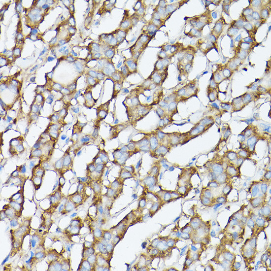 GARS Antibody in Immunohistochemistry (Paraffin) (IHC (P))