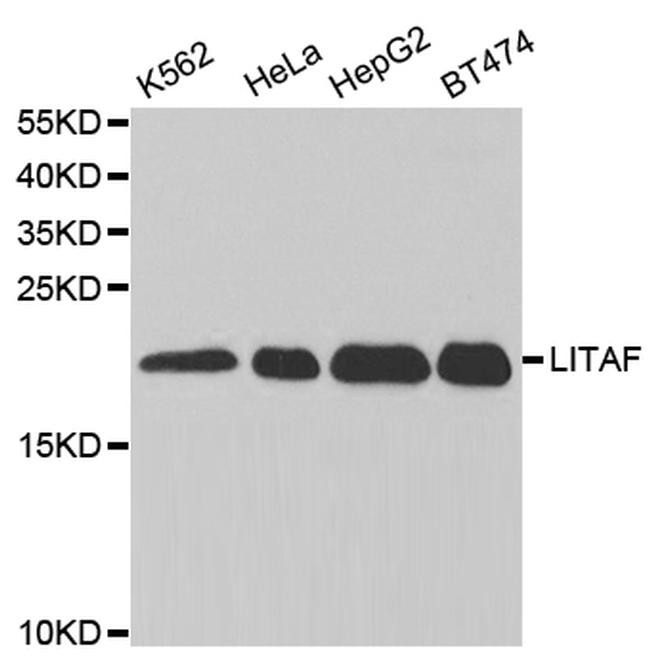 LITAF Antibody in Western Blot (WB)