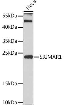 Sigma-1 Receptor Antibody in Western Blot (WB)