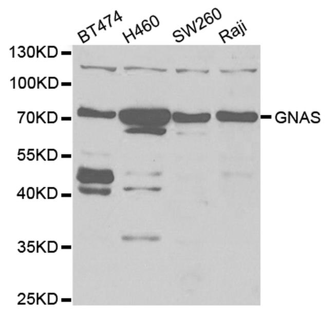 GNAS Antibody in Western Blot (WB)