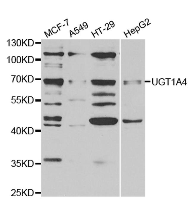 UGT1A4 Antibody in Western Blot (WB)