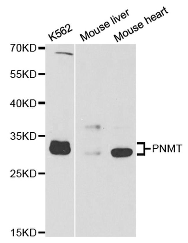 PNMT Antibody in Western Blot (WB)