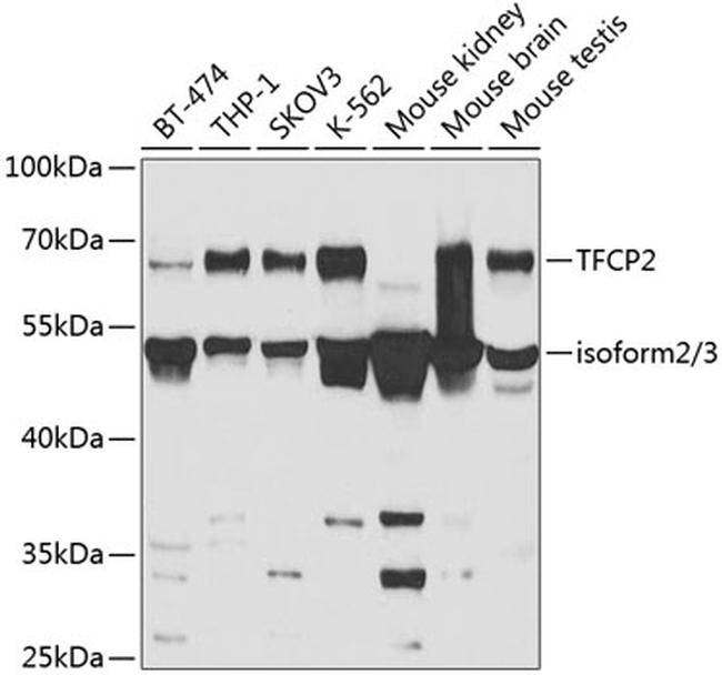 TFCP2 Antibody in Western Blot (WB)