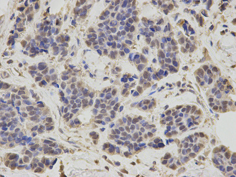 RNF2 Antibody in Immunohistochemistry (Paraffin) (IHC (P))