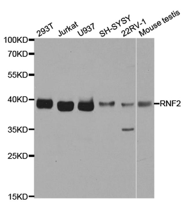 RNF2 Antibody in Western Blot (WB)