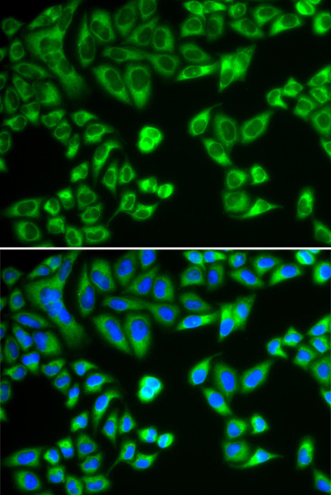 SH2B1 Antibody in Immunocytochemistry (ICC/IF)