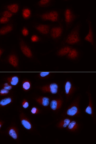 SH2B1 Antibody in Immunocytochemistry (ICC/IF)