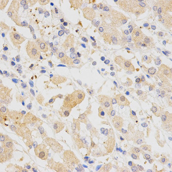 SH2B1 Antibody in Immunohistochemistry (Paraffin) (IHC (P))