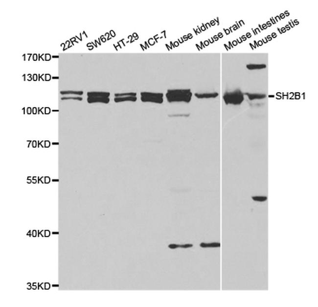 SH2B1 Antibody in Western Blot (WB)