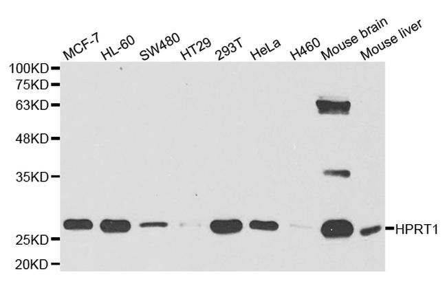 HPRT1 Antibody in Western Blot (WB)