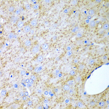 INHA Antibody in Immunohistochemistry (Paraffin) (IHC (P))