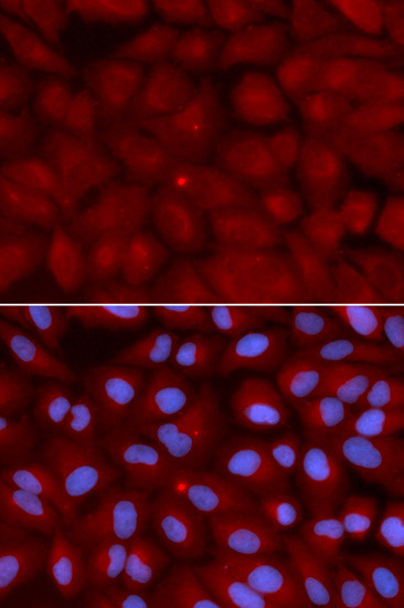 BIN1 Antibody in Immunocytochemistry (ICC/IF)