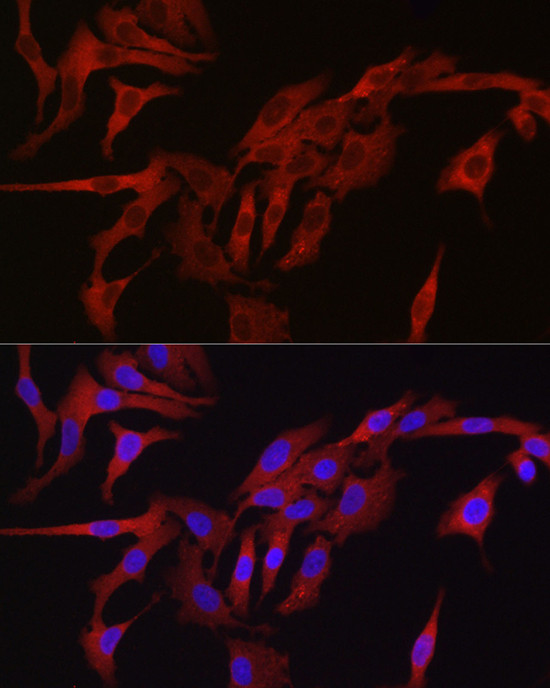 TMPRSS2 Antibody in Immunocytochemistry (ICC/IF)