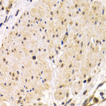 TMPRSS2 Antibody in Immunohistochemistry (Paraffin) (IHC (P))