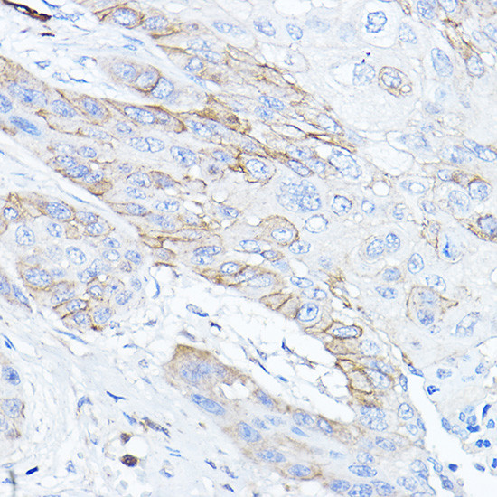 TMPRSS2 Antibody in Immunohistochemistry (Paraffin) (IHC (P))