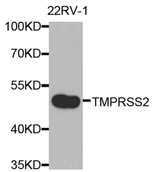 TMPRSS2 Antibody in Western Blot (WB)