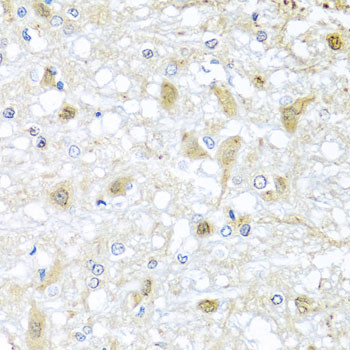 ATP2C1 Antibody in Immunohistochemistry (Paraffin) (IHC (P))