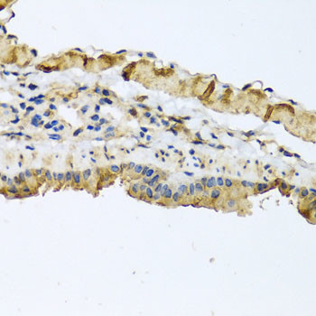 ATP2C1 Antibody in Immunohistochemistry (Paraffin) (IHC (P))