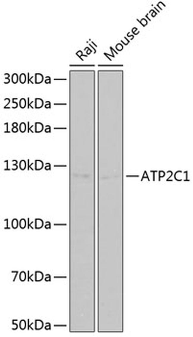 ATP2C1 Antibody in Western Blot (WB)