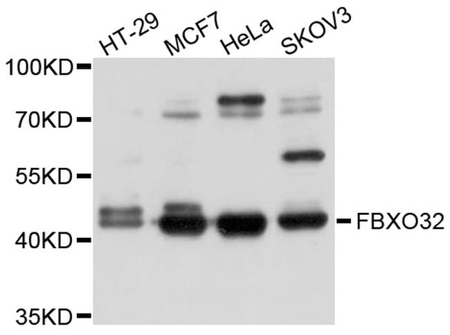 FBXO32 Antibody in Western Blot (WB)