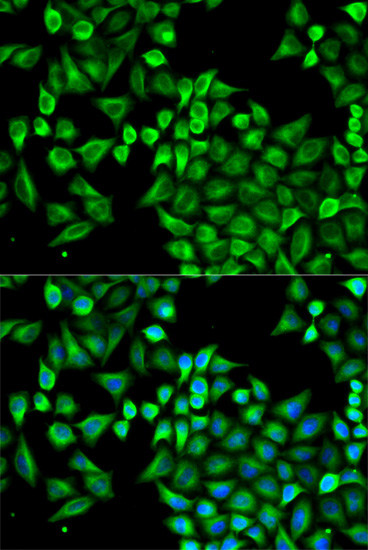 ABAT Antibody in Immunocytochemistry (ICC/IF)