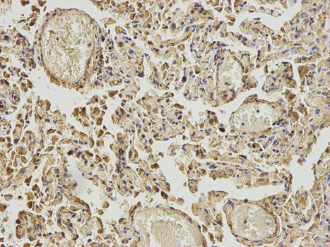 ABAT Antibody in Immunohistochemistry (Paraffin) (IHC (P))