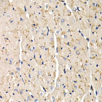 SFRP2 Antibody in Immunohistochemistry (Paraffin) (IHC (P))