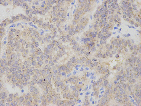 CHMP2B Antibody in Immunohistochemistry (Paraffin) (IHC (P))