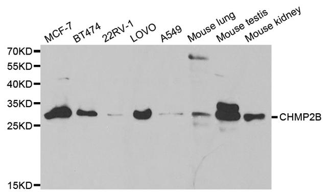 CHMP2B Antibody in Western Blot (WB)