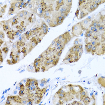 MGP Antibody in Immunohistochemistry (Paraffin) (IHC (P))